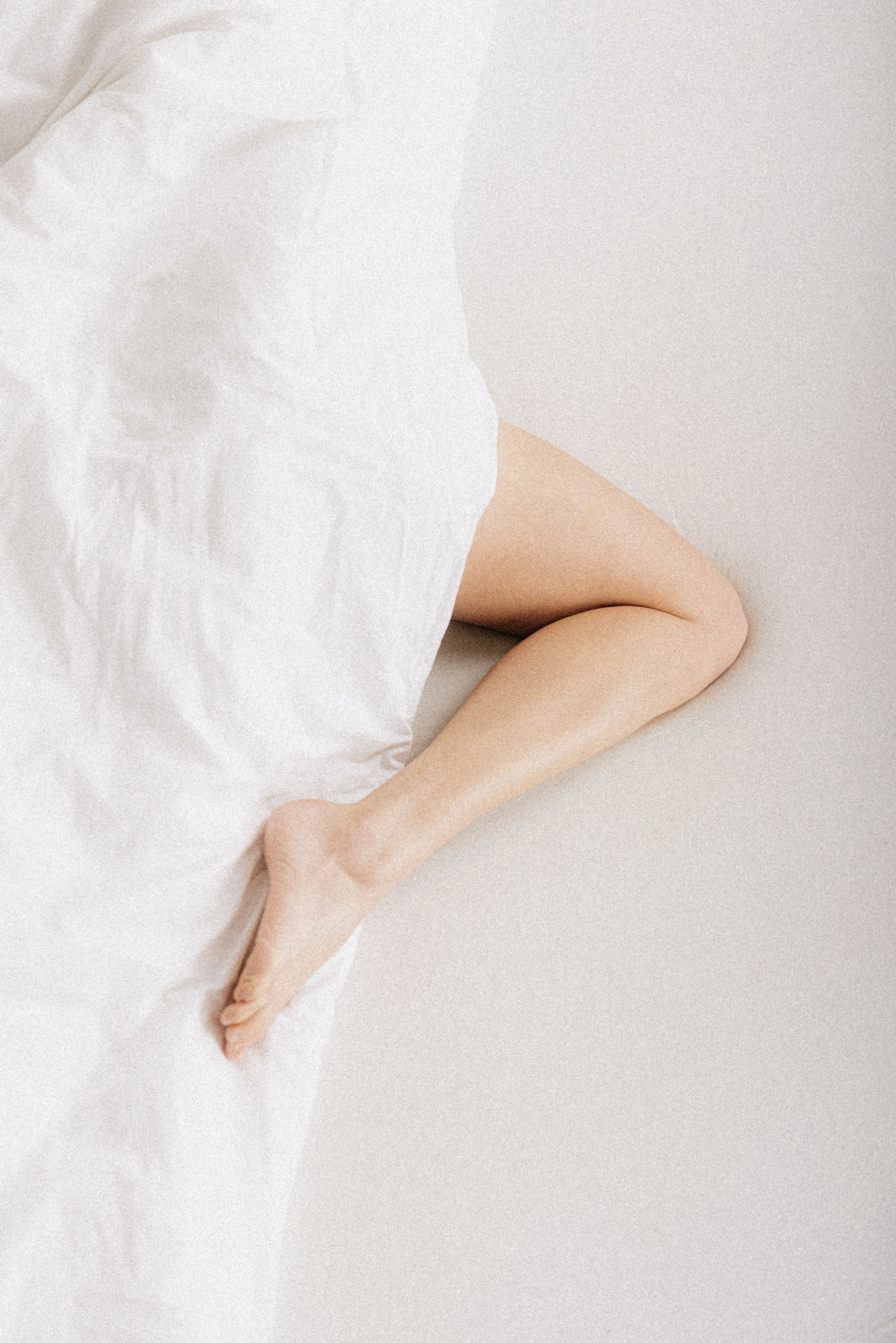 Lipedema